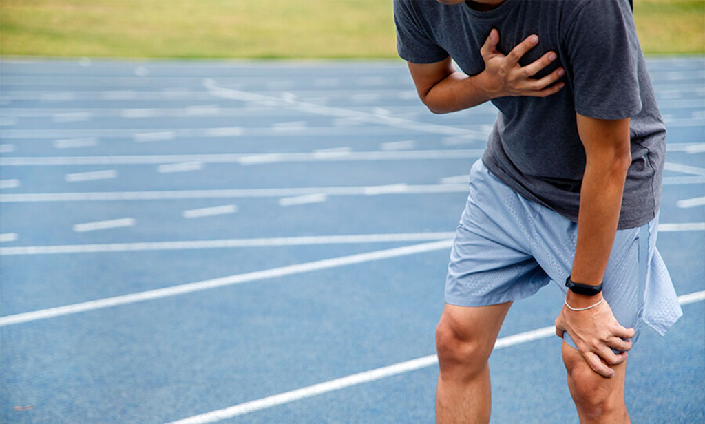 La muerte súbita en el deporte y su prevención